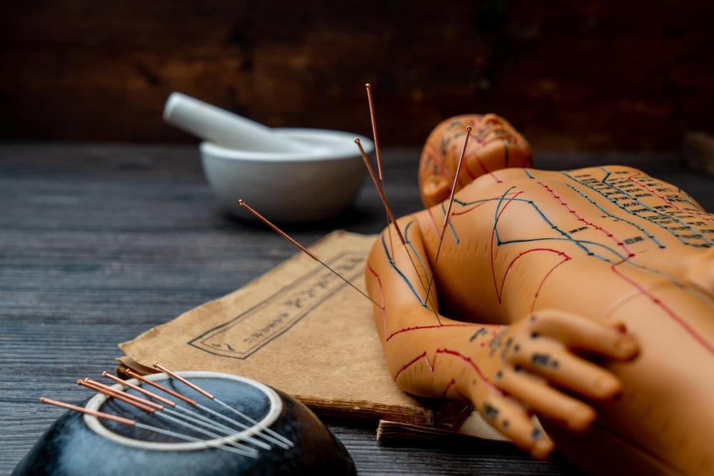 école acupuncture